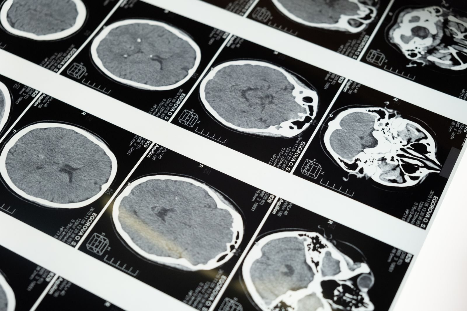 Brain scan imaging in Cody A. Moxam neuroengineering and brain health research